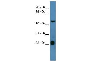 WB Suggested Anti-SSTR1 Antibody Titration: 0. (SSTR1 anticorps  (C-Term))