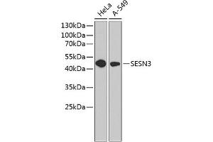 Western blot analysis of extracts of various cell lines, using SESN3 antibody (ABIN6129128, ABIN6147627, ABIN6147628 and ABIN6220862) at 1:1000 dilution. (SESN3 anticorps  (AA 1-310))