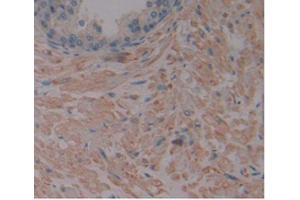 IHC-P analysis of Human Prostate Gland Tissue, with DAB staining. (MMP2 anticorps  (AA 110-660))