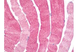 Human Skeletal Muscle: Formalin-Fixed, Paraffin-Embedded (FFPE) (PDCL3 anticorps  (C-Term))