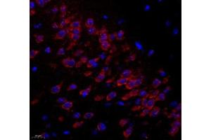 Immunofluorescence of paraffin embedded mouse hippocampus using C1orf173 (ABIN7074073) at dilution of 1: 300 (400x lens) (Glutamate-Rich Protein 3 (ERICH3) anticorps)
