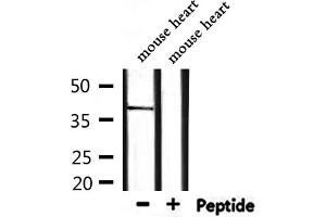 Western blot analysis of extracts from mouse heart, using BMI1 Antibody.