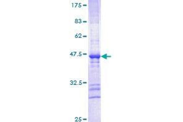 CDH22 Protein (AA 274-383) (GST tag)