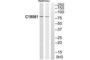 Western blot analysis of extracts from HepG2 cells and COLO205 cells, using NEK5 antibody. (NEK5 anticorps)