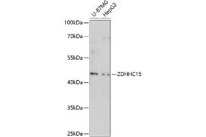 Western blot analysis of extracts of various cell lines, using ZDHHC15 antibody (ABIN7271548) at 1:1000 dilution.