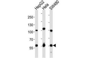 Western blot analysis of lysate from HepG2, HeLa, SW480 cell line using PCSK9 antibody.