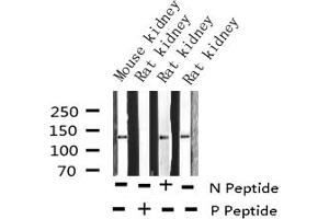 Western blot analysis of Phospho-Calcium Sensing Receptor (Thr888) expression in various lysates