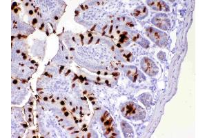 IHC analysis of TFF3 using anti-TFF3 antibody .