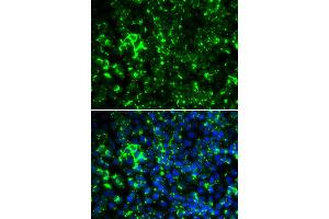 Immunofluorescence analysis of HeLa cells using KCNA2 antibody (ABIN5973718).