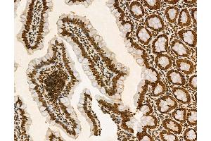 ABIN6263803 and ABIN6272971 at 1/100 staining Rat colon tissue by IHC-P. (alpha KGDHC anticorps  (N-Term))