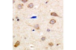 Immunohistochemical analysis of EDG5 staining in human brain formalin fixed paraffin embedded tissue section. (S1PR2 anticorps  (C-Term))