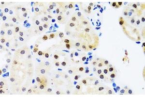 Immunohistochemistry of paraffin-embedded Mouse kidney using SET Polyclonal Antibody at dilution of 1:100 (40x lens). (SET/TAF-I anticorps)
