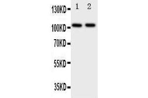 Anti-Zonula occludens protein 3 antibody, Western blotting Lane 1: Rat Brain Tissue Lysate Lane 2: Rat Heart Tissue Lysate (TJP3 anticorps  (C-Term))