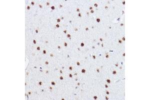 Immunohistochemistry of paraffin-embedded rat brain using p73 Rabbit mAb (ABIN1678945, ABIN1678944, ABIN7101487 and ABIN7101488) at dilution of 1:100 (40x lens).