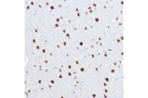 Immunohistochemistry of paraffin-embedded rat brain using p73 Rabbit mAb (ABIN1678945, ABIN1678944, ABIN7101487 and ABIN7101488) at dilution of 1:100 (40x lens). (Tumor Protein p73 anticorps)