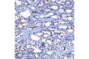 IHC analysis of SF3A1 using anti-SF3A1 antibody (ABIN7600556). (SF3A1 anticorps  (AA 20-556))