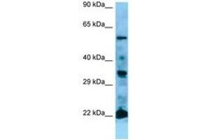 Image no. 1 for anti-GTPase NRas (NRAS) (AA 91-140) antibody (ABIN6749779)