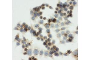 ICC testing of IGF2R antibody and HCT116 cells