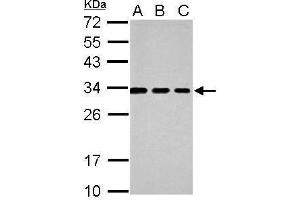 WB Image Sample (30 ug of whole cell lysate) A: 293T B: A431 C: HeLa 12% SDS PAGE antibody diluted at 1:1000 (Tetraspanin 3 anticorps)
