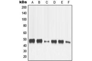Western blot analysis of MMP13 expression in HeLa (A), SP2/0 (B), H9C2 (C), MCF7 (D), HT1080 (E), SCC4 (F) whole cell lysates.