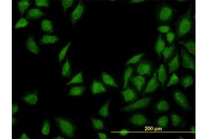 Immunofluorescence of monoclonal antibody to MTAP on HeLa cell. (MTAP anticorps  (AA 1-154))
