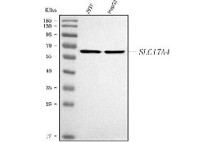 Western blot analysis of SLC17A4 using anti-SLC17A4 antibody (ABIN7599446).