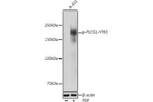 Western blot analysis of extracts of A-431 cells, using Phospho-PLC gamma 1 (PLCG1)-Y783 antibody (ABIN3019685, ABIN3019686, ABIN3019687 and ABIN1681934) at 1:1000 dilution.