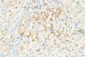 Immunohistochemistry analysis of paraffin-embedded rat ovary using,NRK (ABIN7074842) at dilution of 1: 1500 (NRK anticorps)