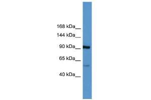 WB Suggested Anti-LPA Antibody Titration: 0. (LPA anticorps  (Middle Region))
