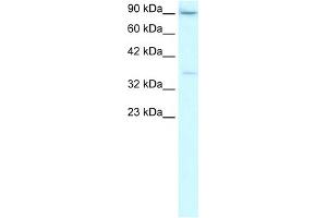 WB Suggested Anti-TBP Antibody Titration:  2. (TBP anticorps  (Middle Region))