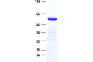 Validation with Western Blot (ZNF772 Protein (His tag))