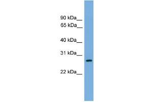 WB Suggested Anti-ATPAF1 Antibody Titration: 0. (ATPAF1 anticorps  (N-Term))