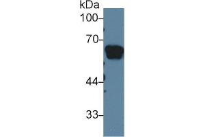 Western Blot; Sample: Rat Serum; Primary Ab: 1µg/ml Rabbit Anti-Rat AGT Antibody Second Ab: 0. (AGT anticorps  (AA 25-477))
