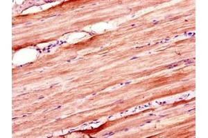 Immunohistochemistry of paraffin-embedded human skeletal muscle tissue using ABIN7176655 at dilution of 1:100 (ZSWIM6 anticorps  (AA 430-583))