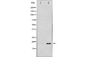 Western blot analysis of Pin1 expression in COS7 whole cell lysates,The lane on the left is treated with the antigen-specific peptide. (PIN1 anticorps)