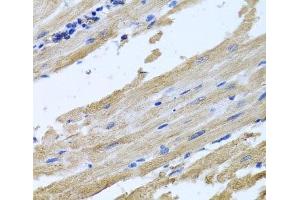 Immunohistochemistry of paraffin-embedded Rat heart using NSF Polyclonal Antibody at dilution of 1:100 (40x lens). (NSF anticorps)