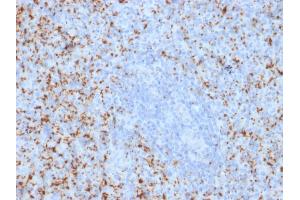 Formalin-fixed, paraffin-embedded human Spleen stained with CD61 Mouse Monoclonal Antibody (ITGB3/2145). (Integrin beta 3 anticorps  (AA 385-490))