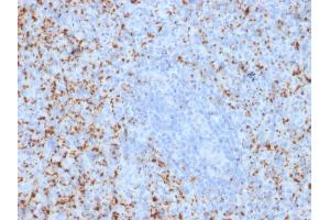 Formalin-fixed, paraffin-embedded human Spleen stained with CD61 Mouse Monoclonal Antibody (ITGB3/2145).