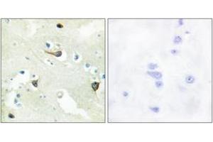 Immunohistochemistry analysis of paraffin-embedded human brain tissue, using EPHB1/2/3 Antibody. (EPH Receptor B1/2/3 (AA 631-680) anticorps)