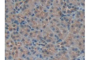 Detection of IGFBP5 in Mouse Kidney Tissue using Polyclonal Antibody to Insulin Like Growth Factor Binding Protein 5 (IGFBP5)