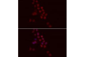 Immunofluorescence analysis of HeLa cells using Histone H1.