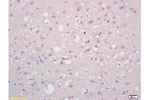 Formalin-fixed and paraffin embedded rat brain labeled with Rabbit Anti PAX6 Polyclonal Antibody, Unconjugated (ABIN1387454) at 1:200 followed by conjugation to the secondary antibody and DAB staining