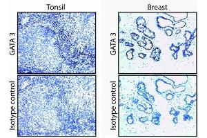 Immunohistochemistry (IHC) image for anti-GATA Binding Protein 3 (GATA3) antibody (ABIN967621)