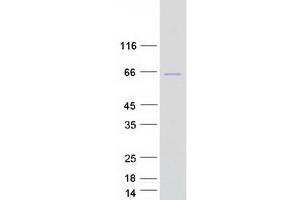 Validation with Western Blot