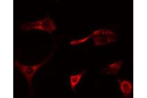 ABIN6278655 staining Hela cells by IF/ICC. (MAP3K1 anticorps  (pThr1402))