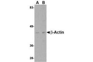 Image no. 1 for anti-Actin, beta (ACTB) (C-Term) antibody (ABIN341734) (beta Actin anticorps  (C-Term))
