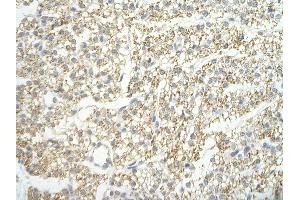 Rabbit Anti-LSM4 antibody   Paraffin Embedded Tissue: Human Heart cell Cellular Data: cardiac cell of renal tubule Antibody Concentration: 4.