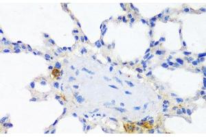 Immunohistochemistry of paraffin-embedded Rat lung using ITGAX Polyclonal Antibody at dilution of 1:100 (40x lens). (CD11c anticorps)