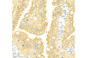 Immunohistochemistry of paraffin embedded rat small intestine using Annexin-A4 (ABIN7073066) at dilution of 1: 1800 (400x lens)