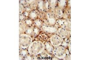 Immunohistochemistry (IHC) image for anti-ATP Synthase, H+ Transporting, Mitochondrial Fo Complex, Subunit J2 (ATP5J2) antibody (ABIN3002313) (ATP5J2 anticorps)